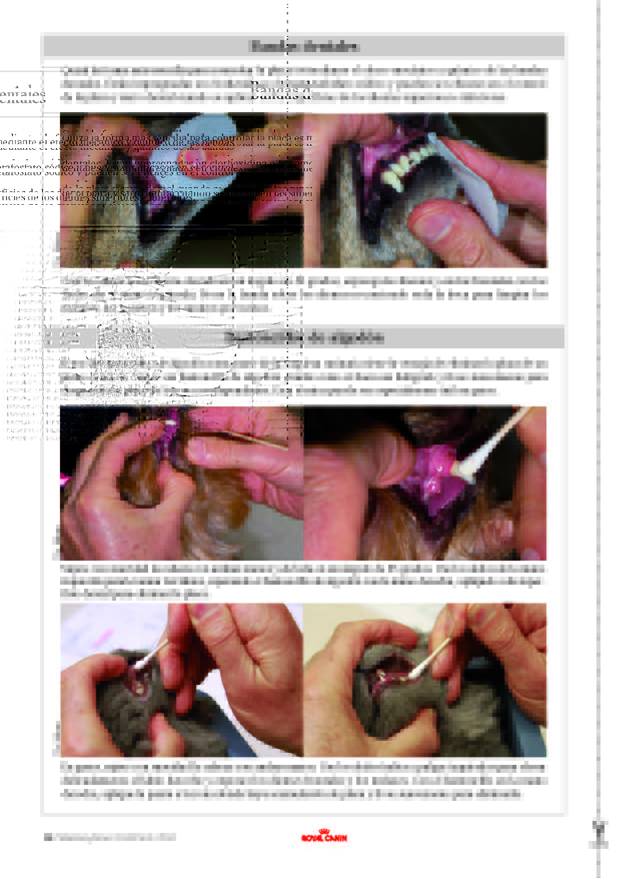 control placa dental